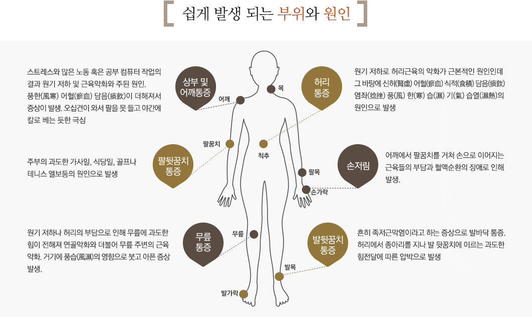 쉽게 발생 되는 부위와 원인